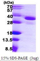 Human EIF2B1 protein, His tag