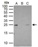 RAB5A antibody