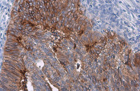 Coagulation factor III/Tissue Factor antibody [N1C3]