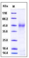 Human Surfactant Protein D protein, His tag