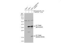 IL1 beta antibody