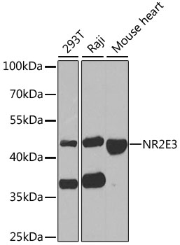 NR2E3 antibody