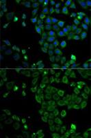 MSR1 antibody