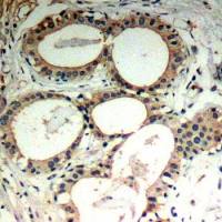 IKB epsilon antibody