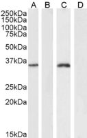 FOXL2 antibody, C-term