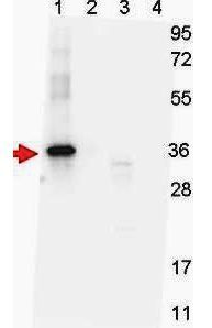 GDF15 (H Variant) antibody [7C12.B3.F2]
