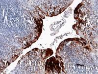 Psoriasin antibody [129]