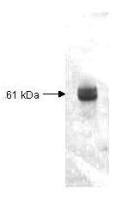 Carboxypeptidase Y antibody