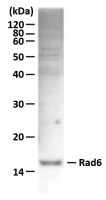 UBE2A + UBE2B antibody