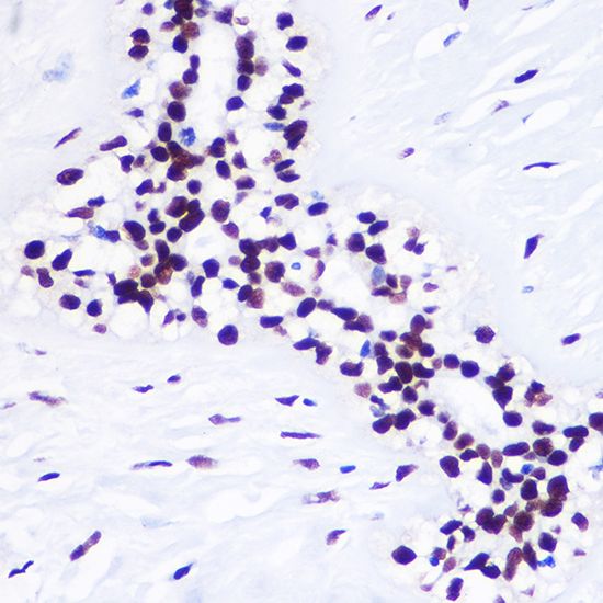 Histone H3K36me3 (tri-methyl Lys36) antibody产品图