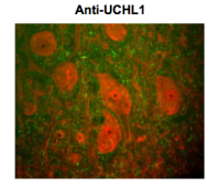 PGP9.5 antibody [BH7]
