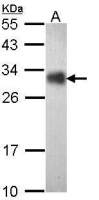 FHL2 antibody