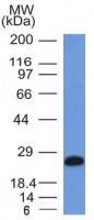 CD79a antibody [IGA/1406]