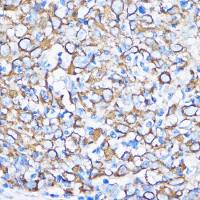 Cytokeratin 5 antibody