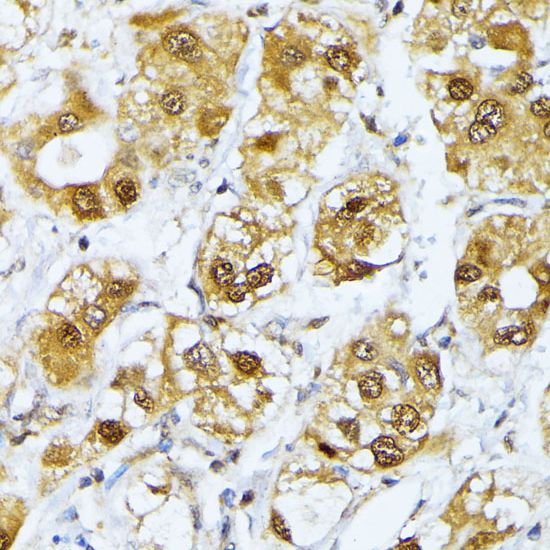 RRAGD antibody
