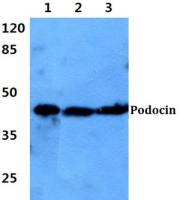 NPHS2 antibody