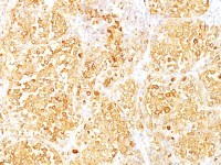 Melan A antibody [M2-9E3]