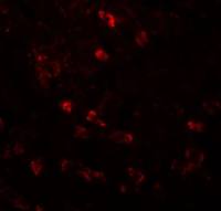 Apc6 antibody
