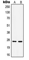 HSP27 (phospho Ser15) antibody