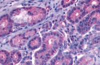 Bradykinin B1 receptor antibody