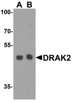 DRAK2 antibody