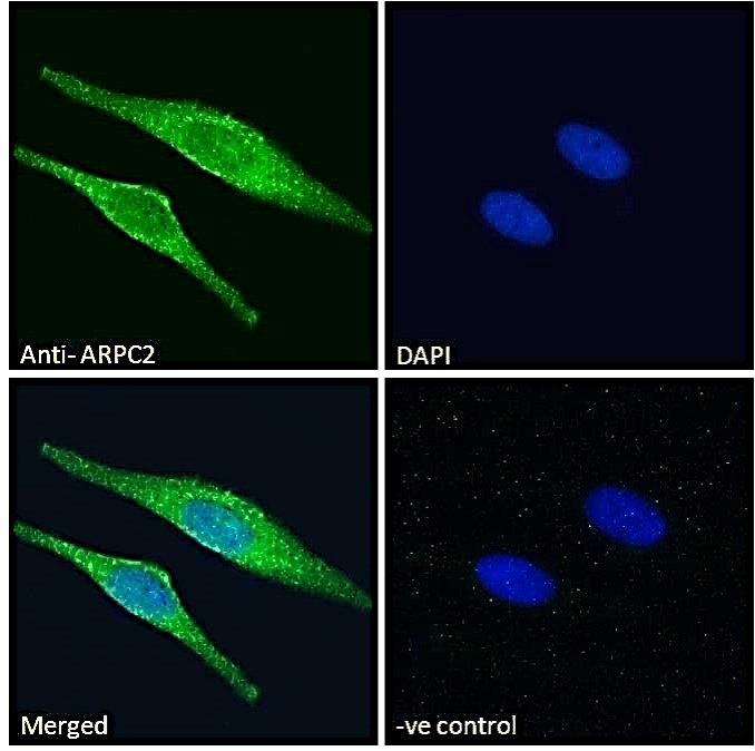 ARPC2 antibody, C-term