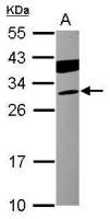 Cardiac Troponin I antibody [N1C3-3]