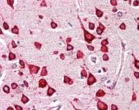 GALR1 antibody [C2C3], C-term