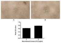 Human EPO protein, His and GST tag (active)