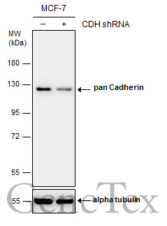 pan Cadherin antibody产品图