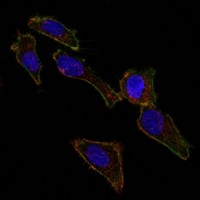 EpCAM antibody [EGP40/826]