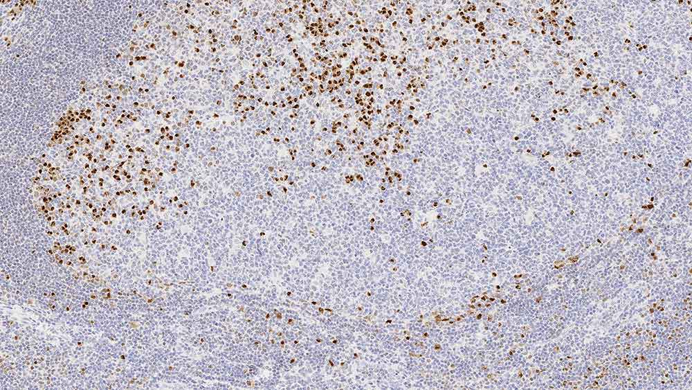 IRF4 / MUM1 antibody [EAU32]