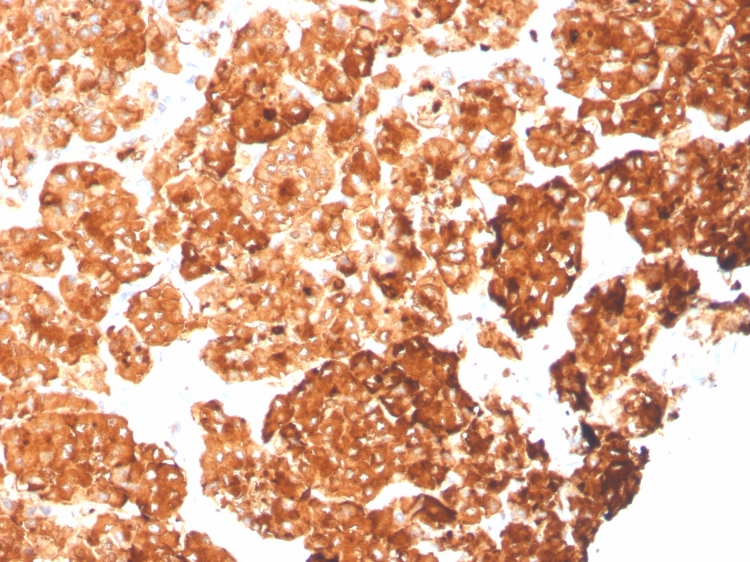 Cytokeratin 6a antibody [rKRT6A/2100]