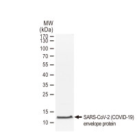 SARS-CoV-2 (COVID-19) Envelope protein, His and Avi tag