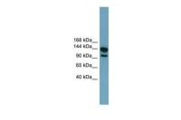 LRRC66 antibody, Internal