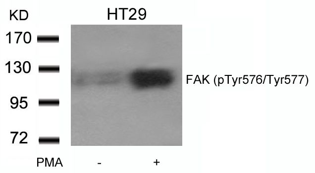 FAK (phospho Tyr576/577) antibody