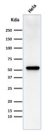 Fascin 1 antibody [FSCN1/418]