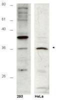 HUS1B antibody