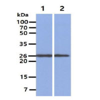 PGP9.5 antibody [3D9]