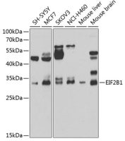 EIF2B1 antibody