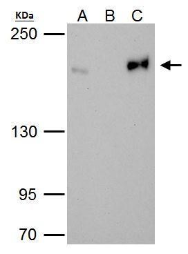 Topoisomerase II beta antibody [C3], C-term