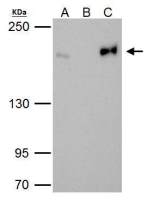 Topoisomerase II beta antibody [C3], C-term
