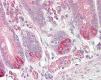 GPCR150 antibody [N2C1], Internal