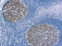 BCL6 antibody [PG-B6]