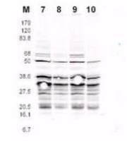 Rfa2 (phospho Ser122) antibody