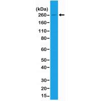 Acetyl-CoA Carboxylase 1 antibody [RM232]