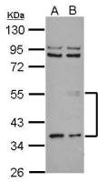 ANGPTL3 antibody