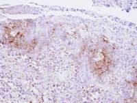 Calcium Sensing Receptor antibody