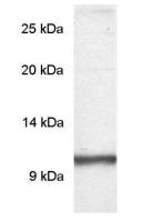 PDE6 gamma antibody
