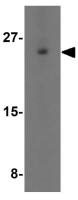 CD81 antibody